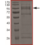 EGFR (d747-749 A750P), Active